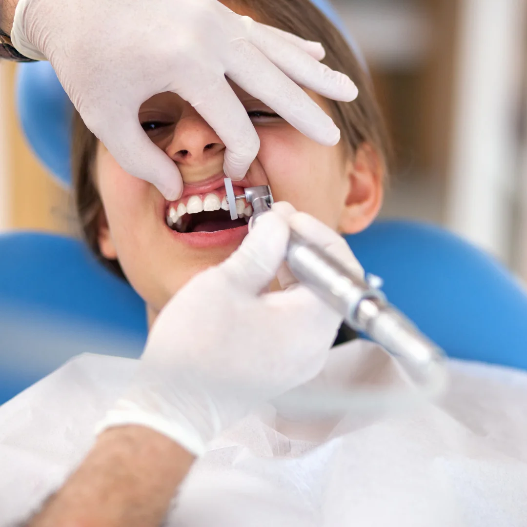 Patient receiving a professional dental cleaning